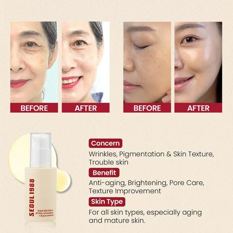 Seoul 1988 Serum : Retinal Liposome 2% + Black Ginseng 30ml image 5